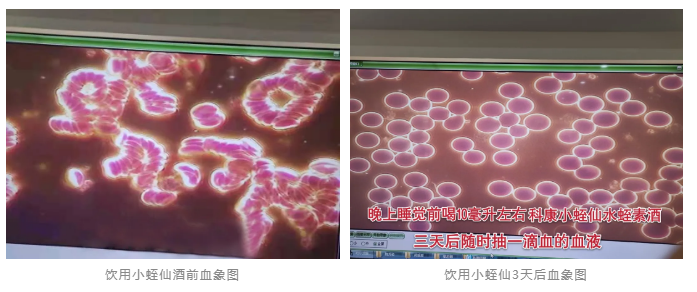 水蛭素、小蛭仙酒、醬香水蛭酒