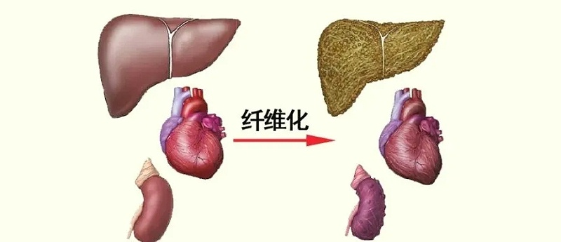 水蛭素、活血化瘀、纖維化