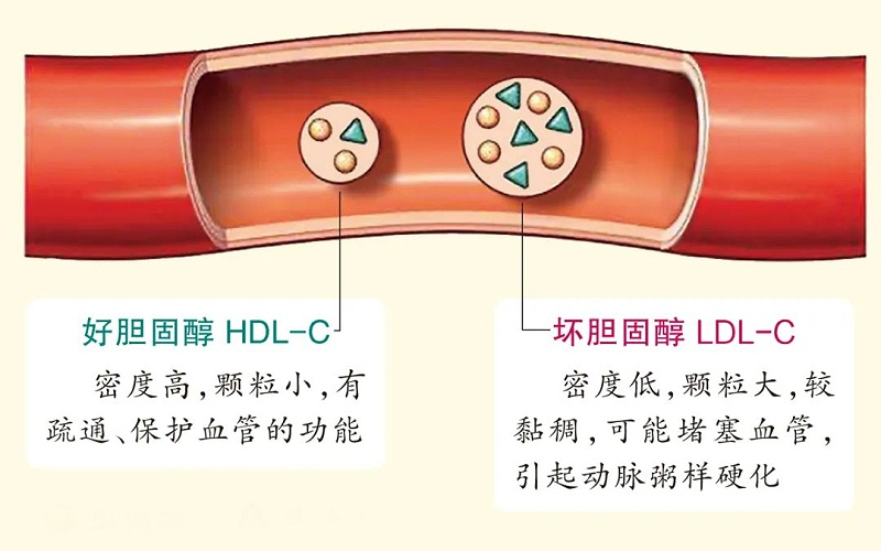 水蛭素、膽固醇、壯醫(yī)水蛭療法培訓(xùn)