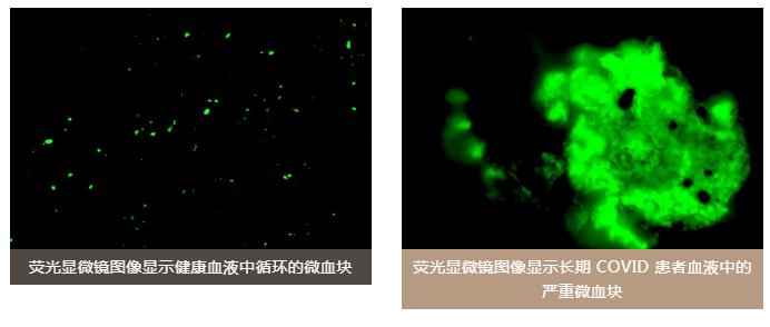 水蛭素、老年癡呆、前列腺、陽(yáng)康