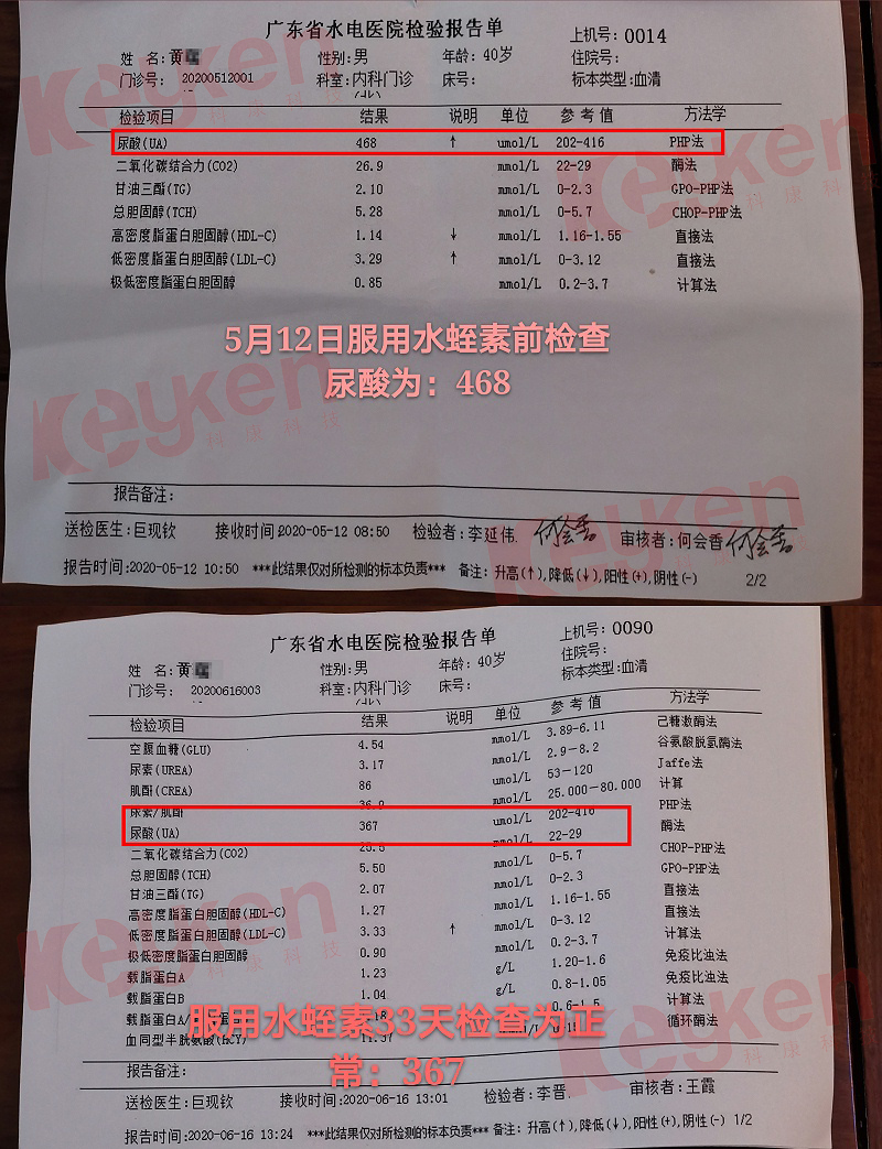 水蛭素、尿酸、痛風(fēng)