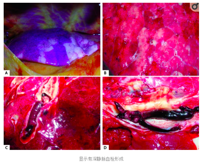 水蛭素、陽(yáng)康、烏梅、壯醫(yī)水蛭療法