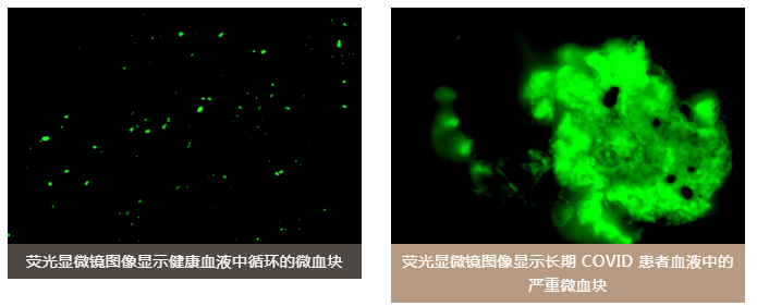 水蛭素、陽(yáng)康、烏梅、壯醫(yī)水蛭療法