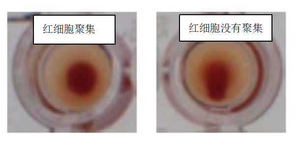 水蛭素、新冠病毒、壯醫(yī)水蛭療法